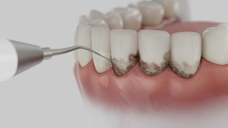 Trusted Dental Crowns And Bridges service in Vincent, AL - Dentist Open Now